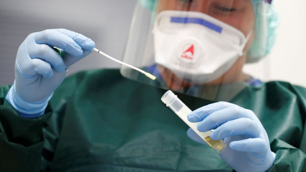 Medidas de proteção contra possíveis infecções por cornoavírus sendo mostradas na clínica universitária de Essen