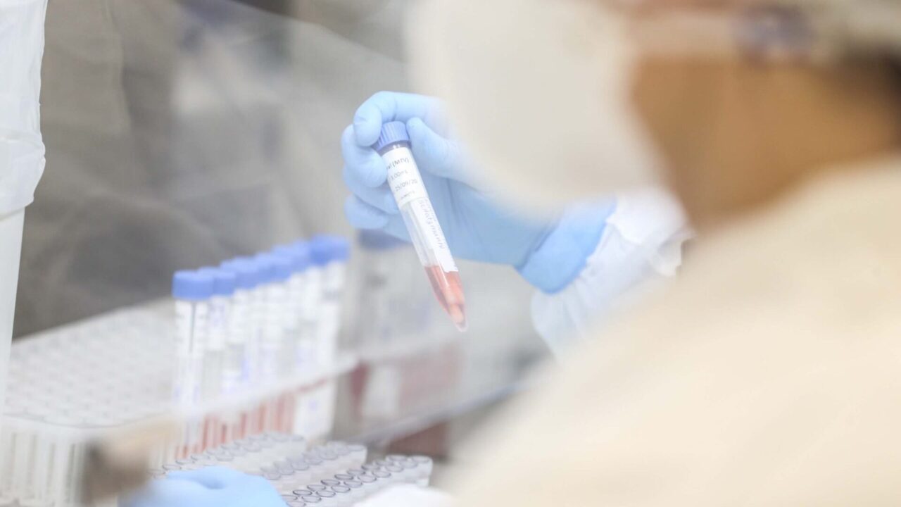 Laboratório Central do Estado - LACEN  -  Recepção  de amostras para teste do Coronavirus. 
Curitiba, 01/04/2020 - Foto: Geraldo Bubniak/AEN